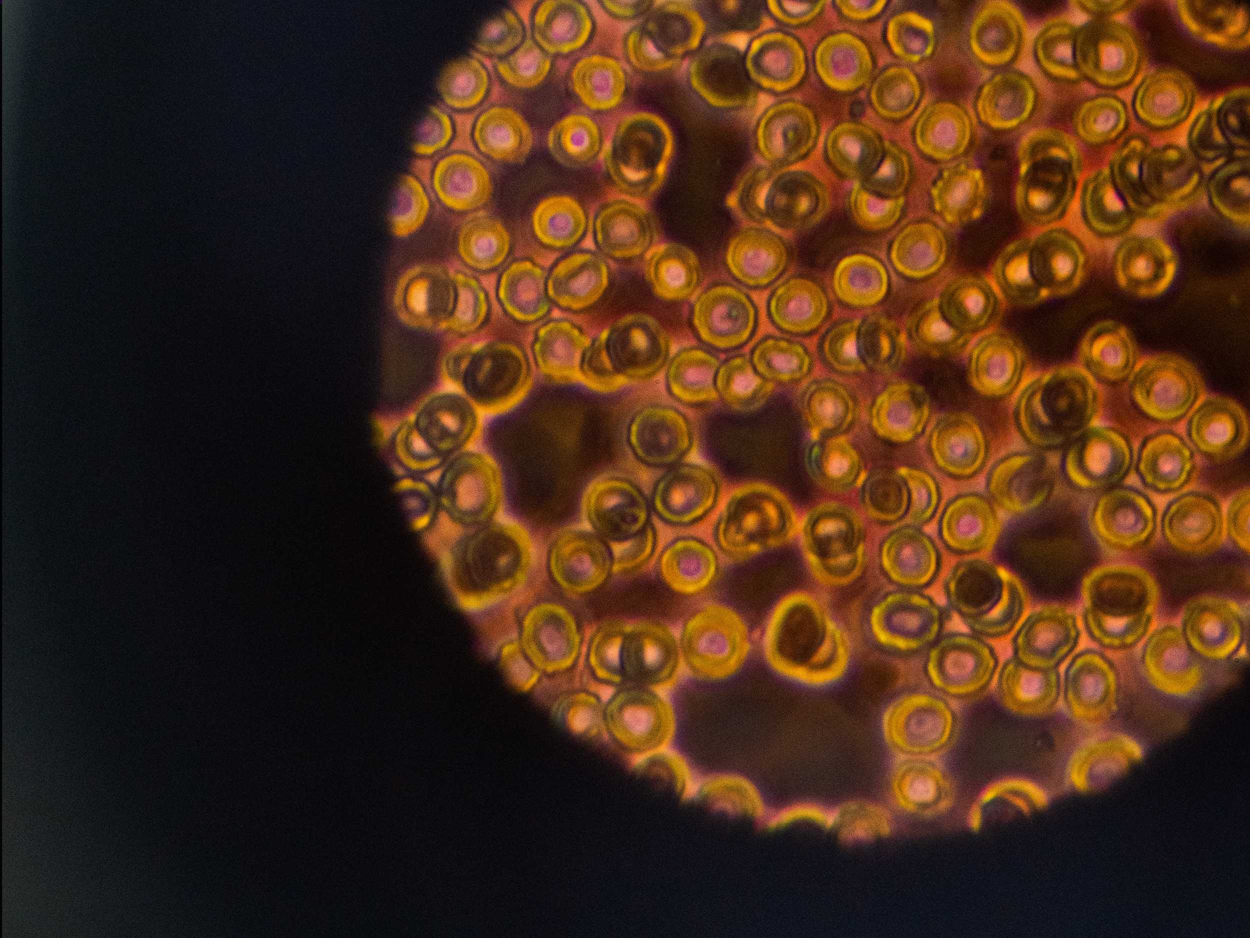 Microscope showing blood cells