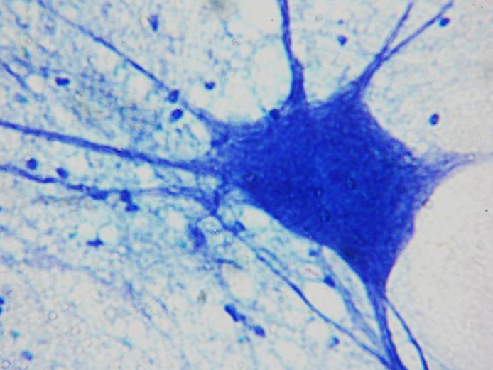 Neuron cell in the brain under a microscope