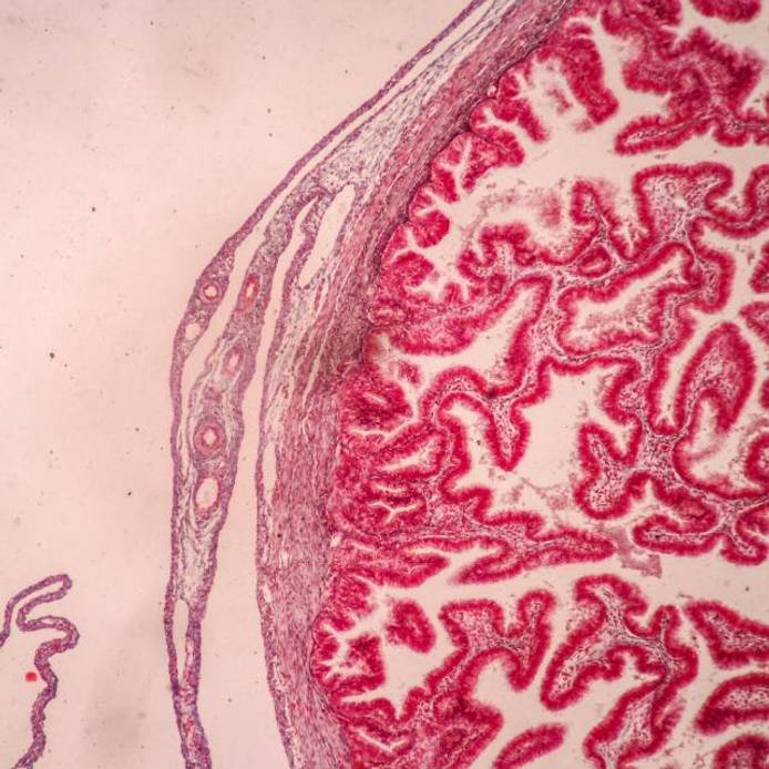 Placenta and umbilical cord under a microscope
